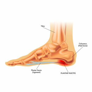 PF Medical Chart2