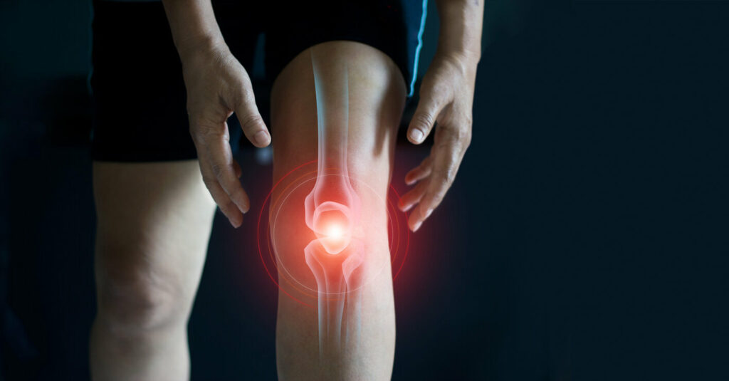 knee sprain injury